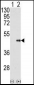 FNTB Antibody (N-term)